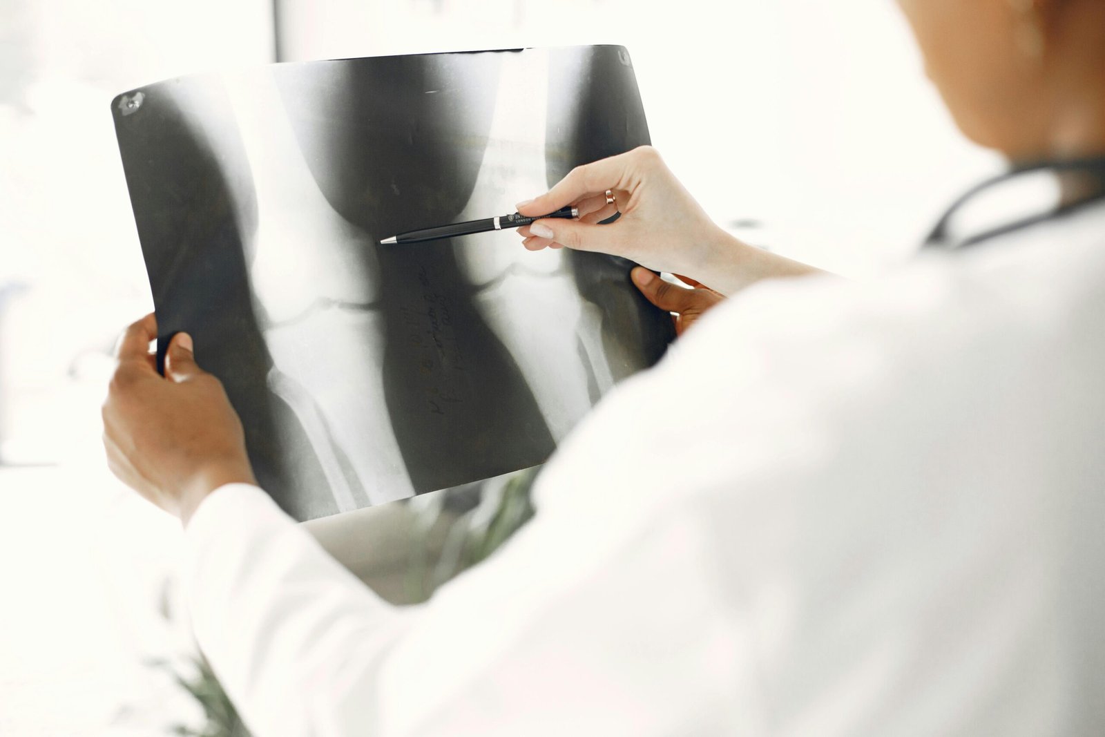 Bone density